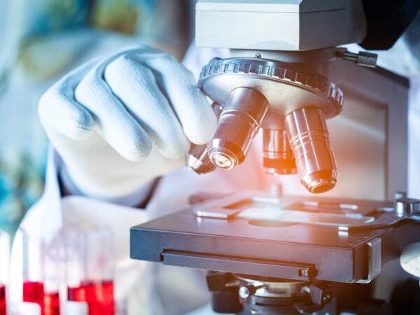 Prodia Hadirkan Advanced Lipid Profile dengan Report   Komprehensif, Bantu Masyarakat Pahami Arti di Balik Angka Kolesterol