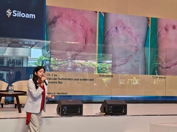 Perdana Bedah Plastik, Rekonstruksi dan Estetik dengan Standar Korea Selatan di Siloam Hospital TB Simatupang